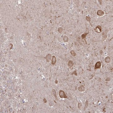 Anti-CAMK2A antibody produced in rabbit Prestige Antibodies® Powered by Atlas Antibodies, affinity isolated antibody, buffered aqueous glycerol solution