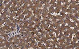 Anti-Transferrin Antibody, clone 2B8 , ZooMAb&#174; Rabbit Monoclonal recombinant, expressed in HEK 293 cells