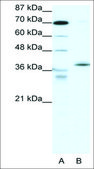Anti-NR2F6 (AB1) antibody produced in rabbit affinity isolated antibody