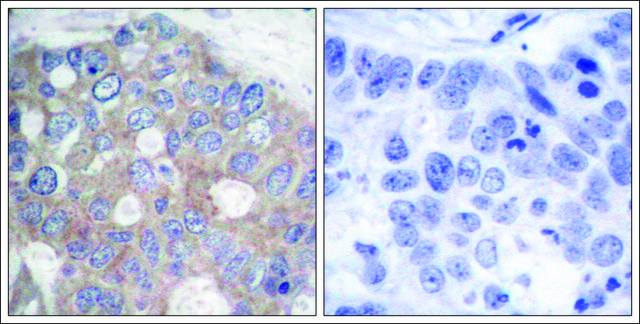 Anti-RPS6KB1 (Ab-421) antibody produced in rabbit affinity isolated antibody
