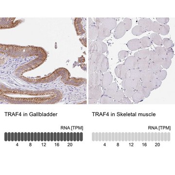 Anti-TRAF4 antibody produced in rabbit Prestige Antibodies&#174; Powered by Atlas Antibodies, affinity isolated antibody, buffered aqueous glycerol solution