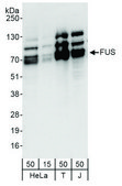 Rabbit anti-FUS Antibody, Affinity Purified Powered by Bethyl Laboratories, Inc.