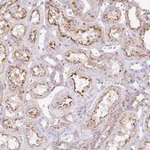Anti-MTTP antibody produced in rabbit Prestige Antibodies&#174; Powered by Atlas Antibodies, affinity isolated antibody, buffered aqueous glycerol solution