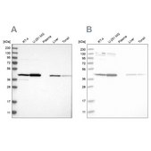 Anti-CNP antibody produced in rabbit Prestige Antibodies&#174; Powered by Atlas Antibodies, affinity isolated antibody, buffered aqueous glycerol solution, Ab3