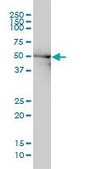 Monoclonal Anti-DDX6 antibody produced in mouse clone 3D2, purified immunoglobulin, buffered aqueous solution