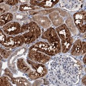 Anti-C20orf196 antibody produced in rabbit Prestige Antibodies&#174; Powered by Atlas Antibodies, affinity isolated antibody, buffered aqueous glycerol solution