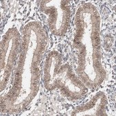 Anti-AHCTF1 antibody produced in rabbit Prestige Antibodies&#174; Powered by Atlas Antibodies, affinity isolated antibody, buffered aqueous glycerol solution