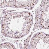 Monoclonal Anti-BRD4 antibody produced in mouse Prestige Antibodies&#174; Powered by Atlas Antibodies, clone CL1115, purified immunoglobulin, buffered aqueous glycerol solution