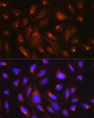 Anti-RheB Antibody, clone 5S8F1, Rabbit Monoclonal