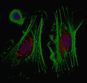 Anti-TERT Antibody from rabbit, purified by affinity chromatography