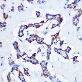 Anti-CBS antibody produced in rabbit