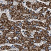 Anti-MDH2 antibody produced in rabbit Prestige Antibodies&#174; Powered by Atlas Antibodies, affinity isolated antibody, buffered aqueous glycerol solution