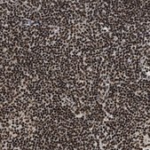 Anti-RAD21 antibody produced in rabbit Prestige Antibodies&#174; Powered by Atlas Antibodies, affinity isolated antibody, buffered aqueous glycerol solution