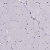 Anti-CCDC40 antibody produced in rabbit Prestige Antibodies&#174; Powered by Atlas Antibodies, affinity isolated antibody, buffered aqueous glycerol solution