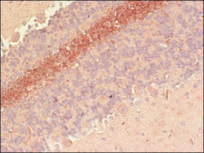 Anti-Nicastrin antibody produced in rabbit IgG fraction of antiserum, buffered aqueous solution
