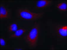 Anti-RPS6KB1 (Ab-424) antibody produced in rabbit affinity isolated antibody