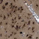 Anti-PFKP antibody produced in rabbit Prestige Antibodies&#174; Powered by Atlas Antibodies, affinity isolated antibody, buffered aqueous glycerol solution