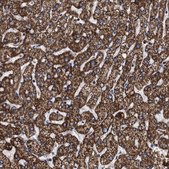 Anti-COG5 antibody produced in rabbit Prestige Antibodies&#174; Powered by Atlas Antibodies, affinity isolated antibody, buffered aqueous glycerol solution