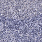 Anti-ENO3 antibody produced in rabbit Prestige Antibodies&#174; Powered by Atlas Antibodies, affinity isolated antibody, buffered aqueous glycerol solution