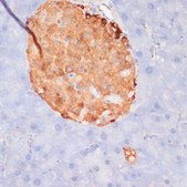 Anti-Phospho-ACLY-S455 antibody produced in rabbit