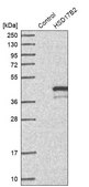 Anti-HSD17B2 antibody produced in rabbit Prestige Antibodies&#174; Powered by Atlas Antibodies, affinity isolated antibody, buffered aqueous glycerol solution