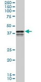 Monoclonal Anti-PCBP2 antibody produced in mouse clone 3A1, purified immunoglobulin, buffered aqueous solution