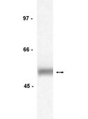 Anti-Lck Antibody, clone 3A5 clone 3A5, Upstate®, from mouse