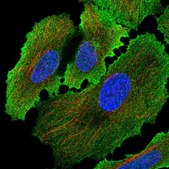 Anti-ALPP antibody produced in rabbit Prestige Antibodies&#174; Powered by Atlas Antibodies, affinity isolated antibody, buffered aqueous glycerol solution