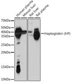 Anti-Haptoglobin (HP) antibody produced in rabbit