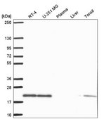 Anti-SKP1 antibody produced in rabbit Prestige Antibodies&#174; Powered by Atlas Antibodies, affinity isolated antibody