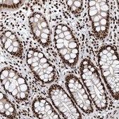 Anti-SENP7 antibody produced in rabbit Prestige Antibodies&#174; Powered by Atlas Antibodies, affinity isolated antibody, buffered aqueous glycerol solution