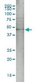 Monoclonal Anti-MAP2K5 antibody produced in mouse clone M1-E6, purified immunoglobulin, buffered aqueous solution