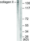 Anti-Collagen II antibody produced in rabbit affinity isolated antibody