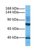 Anti-REST affinity isolated antibody
