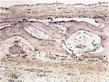 Anti-Osteopontin Antibody serum, Chemicon&#174;