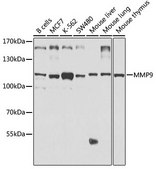 Anti-MMP9 antibody produced in rabbit