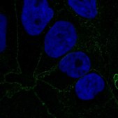 Anti-CTNNA1 antibody produced in rabbit Prestige Antibodies&#174; Powered by Atlas Antibodies, affinity isolated antibody, buffered aqueous glycerol solution