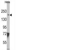 Anti-JMJD3 (NT) Antibody from rabbit