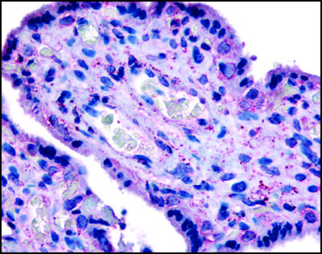 Anti-SLC7A5 (AB2) antibody produced in rabbit affinity isolated antibody, buffered aqueous solution