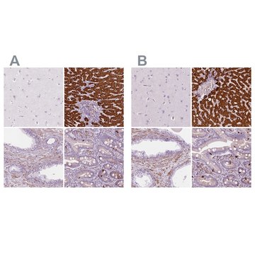 Anti-CES1 antibody produced in rabbit Prestige Antibodies® Powered by Atlas Antibodies, affinity isolated antibody, buffered aqueous glycerol solution
