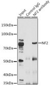 Anti- NF2 antibody produced in rabbit