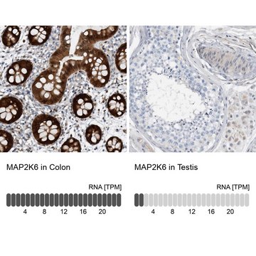 Anti-MAP2K6 antibody produced in rabbit Prestige Antibodies&#174; Powered by Atlas Antibodies, affinity isolated antibody, buffered aqueous glycerol solution