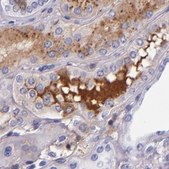 Anti-KNG1 antibody produced in rabbit Ab1, Prestige Antibodies&#174; Powered by Atlas Antibodies, affinity isolated antibody, buffered aqueous glycerol solution