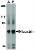 Anti-Nicastrin (ab2) antibody produced in rabbit affinity isolated antibody, buffered aqueous solution