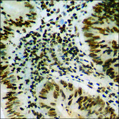 Anti-phospho-Catenin-&#948;1 (pTyr228) antibody produced in rabbit affinity isolated antibody