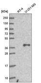 Anti-GNA11 antibody produced in rabbit Prestige Antibodies&#174; Powered by Atlas Antibodies, affinity isolated antibody, buffered aqueous glycerol solution