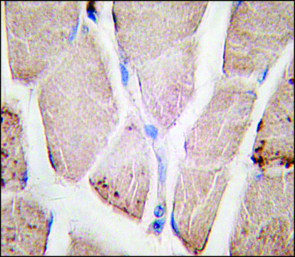 Anti-PYGM (C-term) antibody produced in rabbit Ig fraction of antiserum, buffered aqueous solution