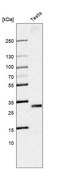 Anti-SLC25A5 antibody produced in rabbit Prestige Antibodies&#174; Powered by Atlas Antibodies, affinity isolated antibody