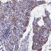 Anti-TRPM7 antibody produced in rabbit Prestige Antibodies&#174; Powered by Atlas Antibodies, affinity isolated antibody