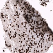 Monoclonal Anti-EZH2 antibody produced in mouse Prestige Antibodies® Powered by Atlas Antibodies, clone CL11915, purified immunoglobulin, buffered aqueous glycerol solution